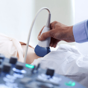 Ecógrafo - ecografía en fisioterapia