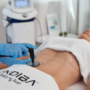 Indiba - radiofrecuencia en fisioterapia